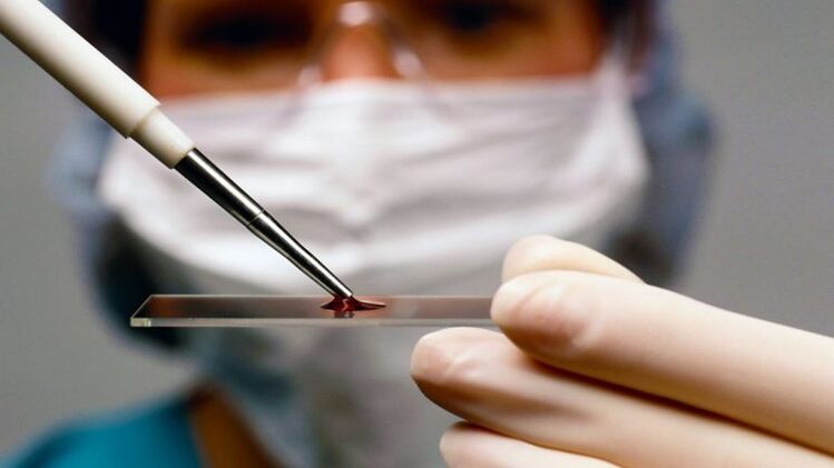 Proba de sangue