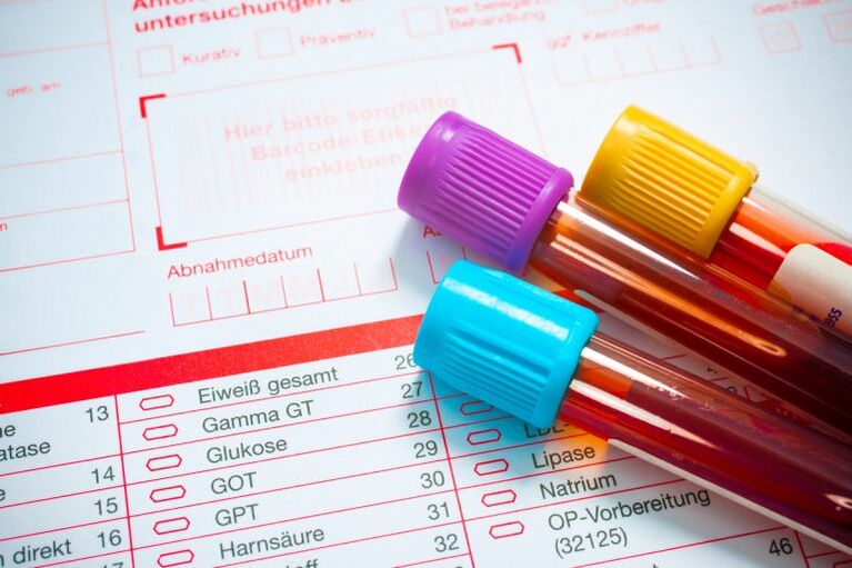 Sangue para a investigación sobre parasitos