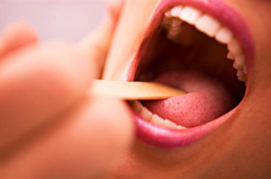 tipos de parasitos na boca humana